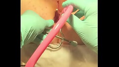 Enema at gyno exam Thumb